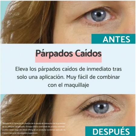 REMESCAR PARPADOS CAIDOS INGREDIENTES VEGETALES 8 ML