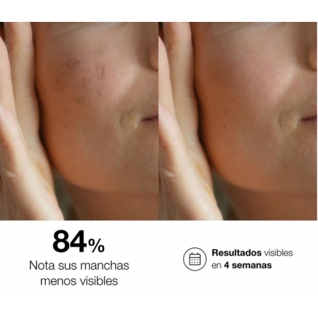 BELLA AURORA BIO10 FORTE L-OCAL NOCHE SERUM DESPIGMENTANTE 9 ML